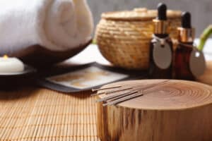 L'acupuncture Une fenêtre sur la médecine traditionnelle chinoise