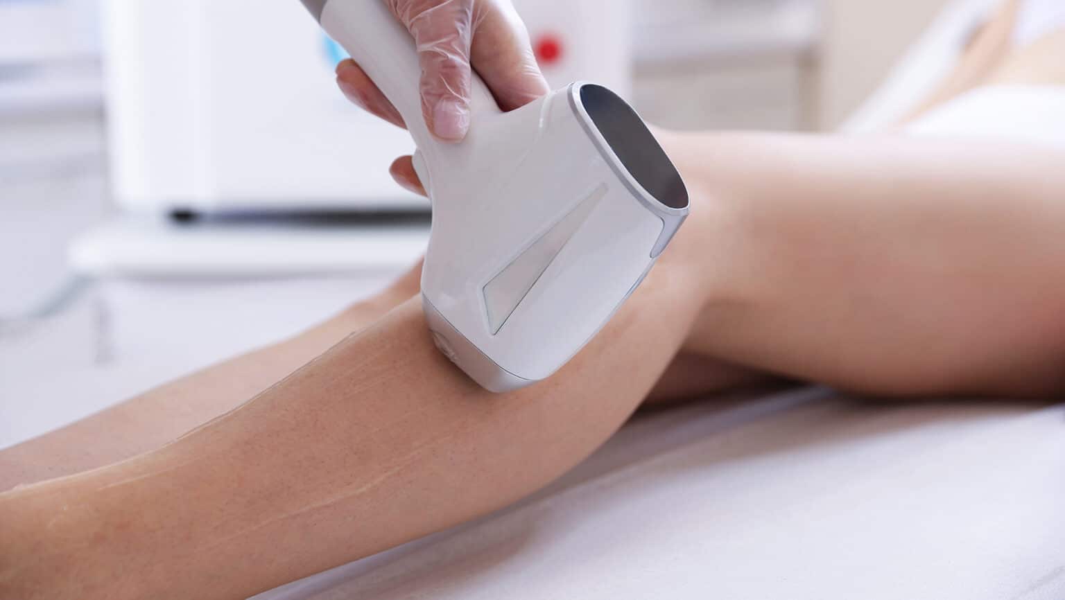 Épilation au laser et soins médico-esthétiques à Saint-Bruno : La solution définitive contre les poils incarnés et l'irritation cutanée.