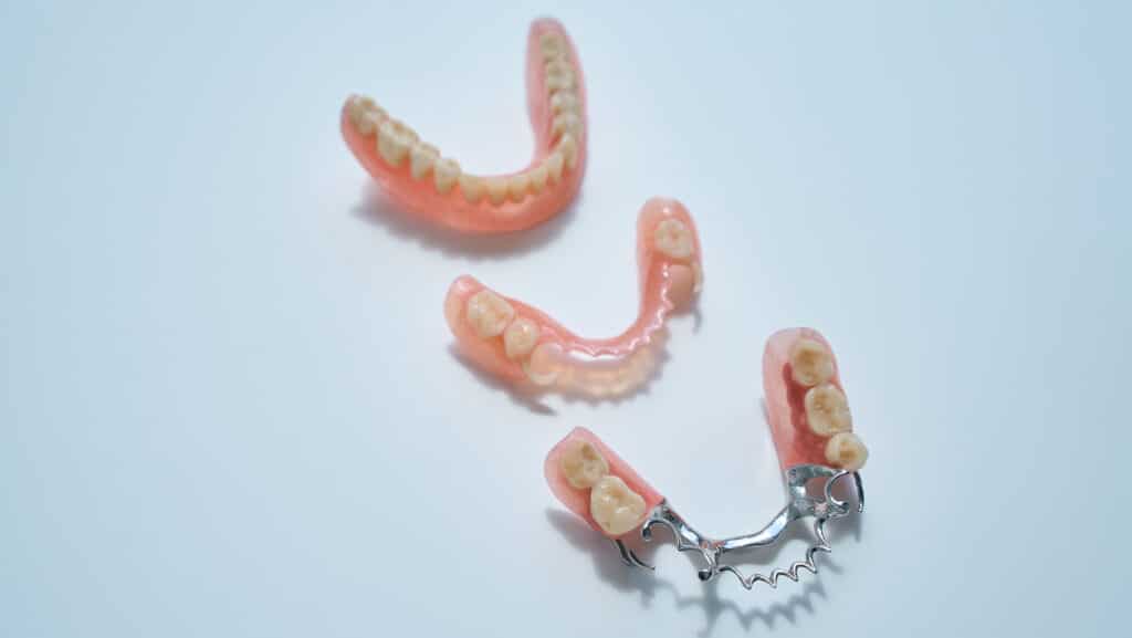 Prothèses dentaires partielles amovibles : Remplacer des dents manquantes sans chirurgie