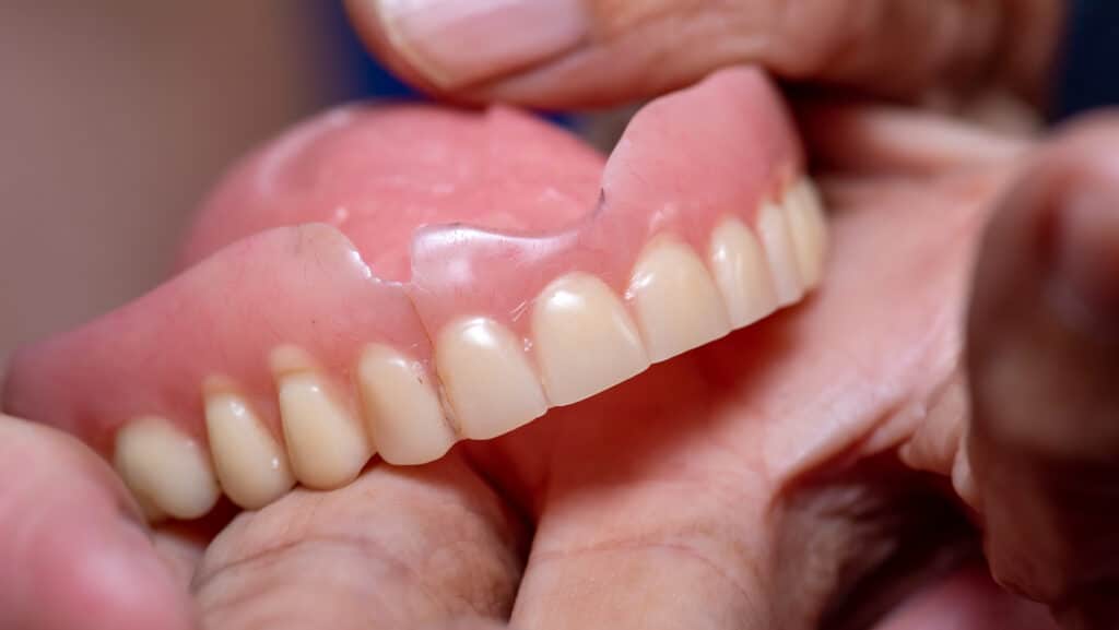 Urgence et réparation de prothèse dentaire brisée ou mal ajustée à Beloeil